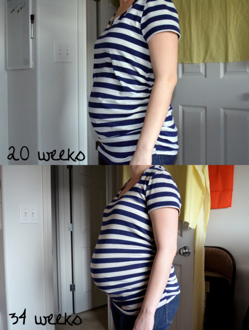 20 weeks vs. 34 weeks
