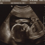 Isla - 24 week ultrasound