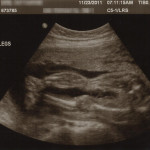 Isla - 24 week ultrasound