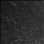 Epidermis Muster burger