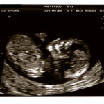 Baking #2: NT Scan and Panorama Results
